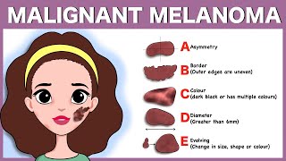 Acute leukemia  Hematologic System Diseases  NCLEXRN  Khan Academy [upl. by Darlleen100]