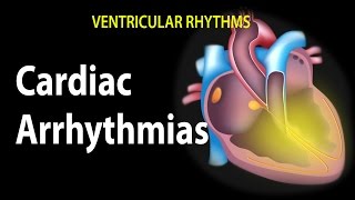 Cardiac Arrhythmias Animation [upl. by Cheri226]