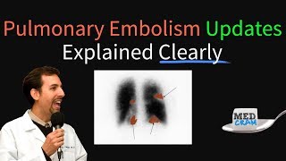 Pulmonary Embolism  Thromboembolism Updates Explained Clearly [upl. by Walcoff]