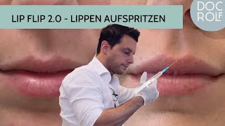 LIPPEN AUFSPRITZEN mit HYALURON amp BOTOX  der LIP FLIP 20 [upl. by Freya]