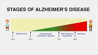 Diagnosing Alzheimer’s Disease [upl. by Viviane]