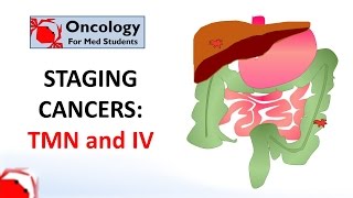 The Staging and Grading of Cancer [upl. by Kohsa]