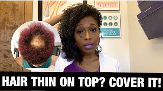 Natural Hairstyles for THINNING Crown [upl. by Mailliwnhoj848]