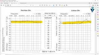 Was ist ein Hörtest Verbesserungen sind möglich [upl. by Vinna]
