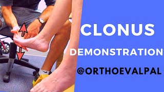 Clonus Demonstration with Ortho Eva Pal [upl. by Aili568]