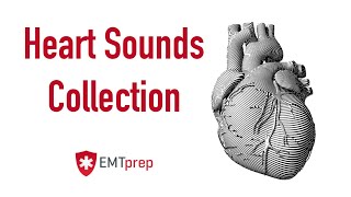 Normal Sinus Rhythm  EKG ECG Interpretation [upl. by Retrac543]