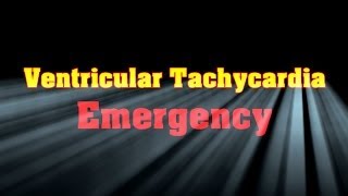 Ventricular Tachycardia Emergency [upl. by Flossie]