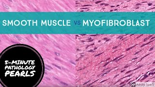 Myofibroblasts vs Smooth Muscle Made Easy 5Minute Pathology Pearls [upl. by Jandy]