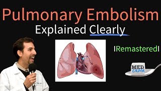 Pulmonary Embolism Remastered  Pathophysiology Symptoms Diagnosis DVT [upl. by Hnahk864]