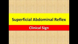 Superficial Abdominal Reflex  Clinical Sign  Neurology [upl. by Koblick]