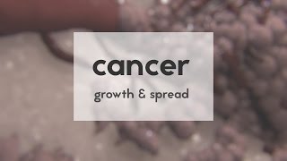 Cancer growth amp spread [upl. by Lilyan]