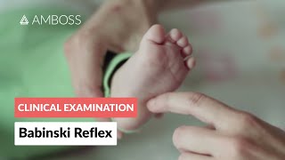 Babinski Reflex in Infants  Clinical Examination [upl. by Rogovy]