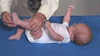 Neurology Exam 3 Month Primitive ReflexesGrasp [upl. by Adalie]